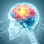 Is Stem Cell Therapy A Cure For Neurodegenerative Diseases