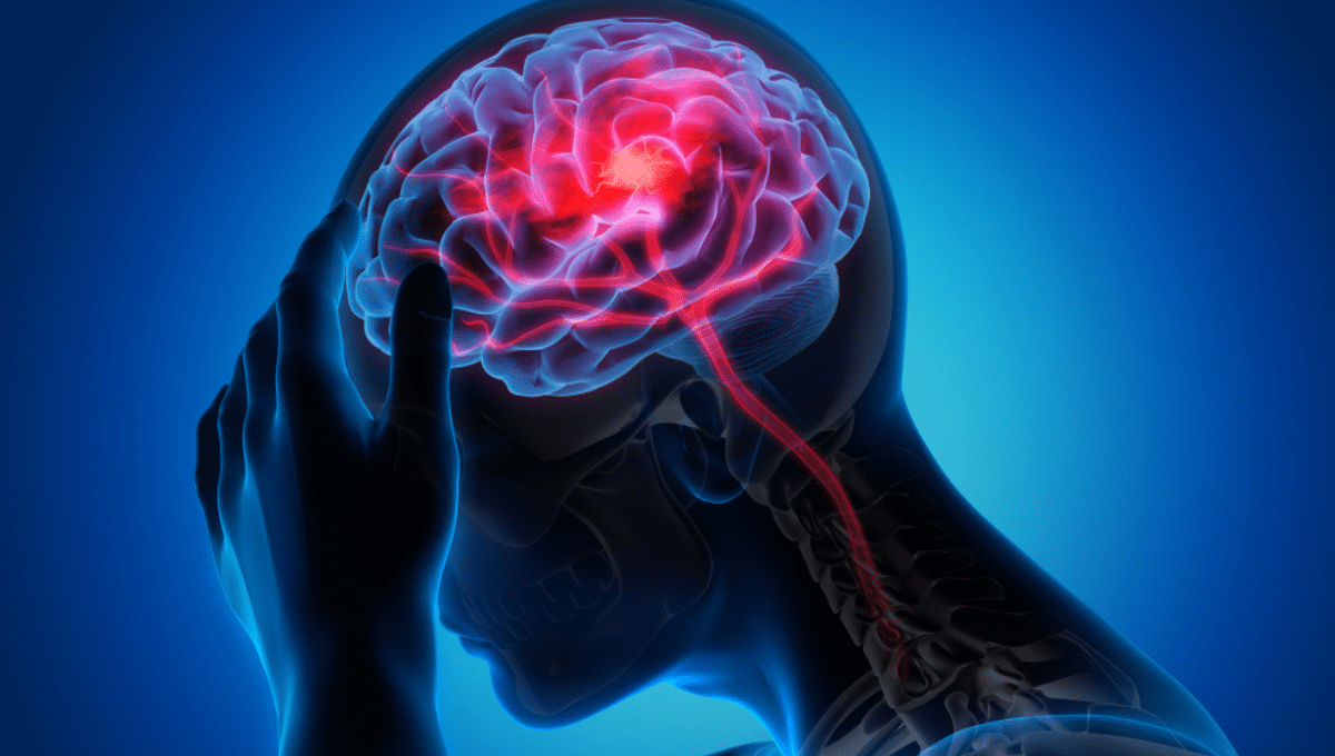 Stem Cell Therapy: Ischemic Stroke Recovery Breakthrough