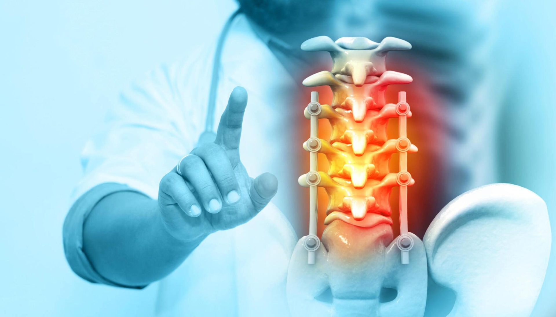 Stem Cell Therapy: A Non-surgical Alternative To Spinal Stenosis