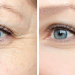 Can Stem Cell Therapy Delay Aging and Make You Look Younger?