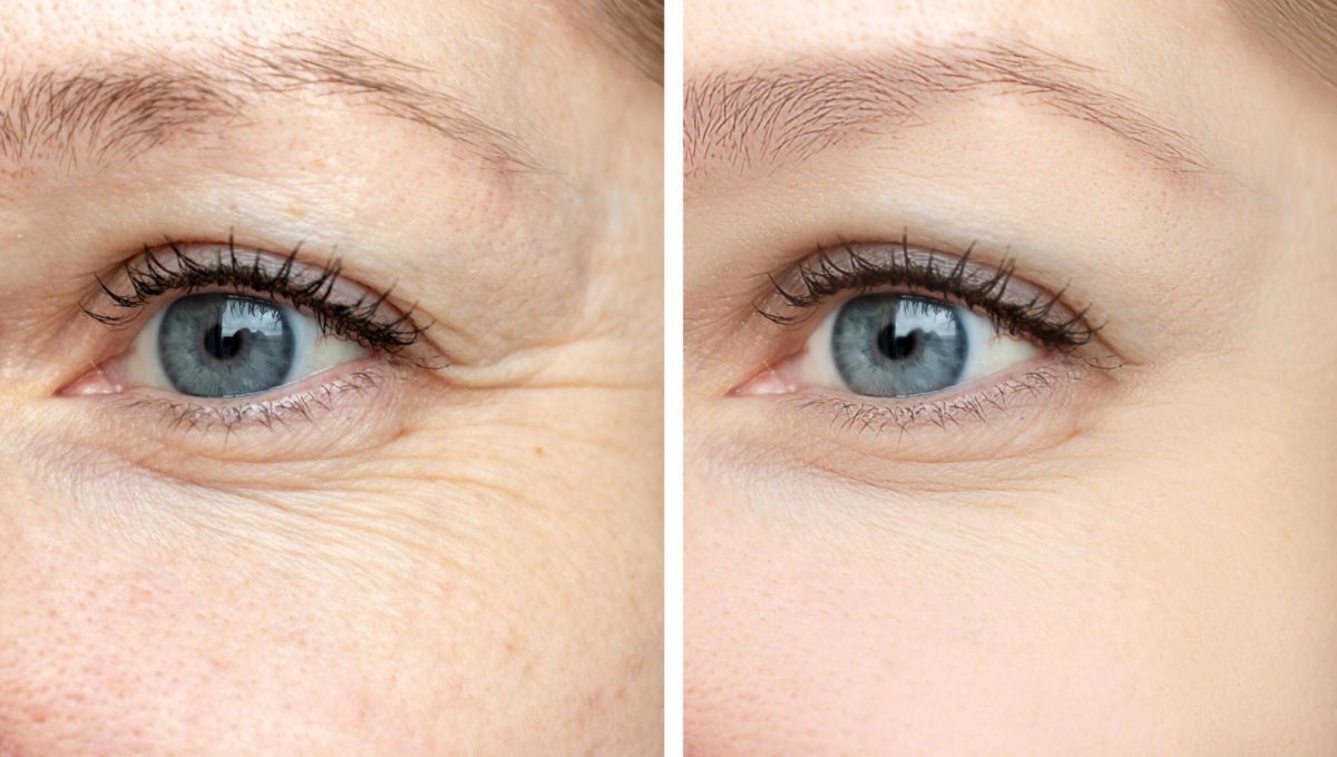 Can Stem Cell Therapy Delay Aging and Make You Look Younger?