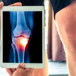 Stem Cell Therapy for Osteoarthritis: How Does It Work?