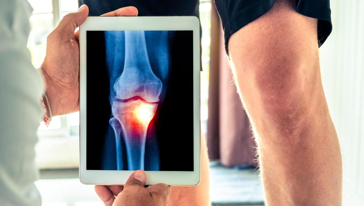 Stem Cell Therapy for Osteoarthritis: How Does It Work?