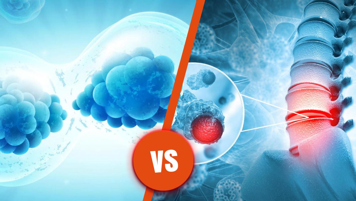 Stem Cell Therapy Vs Spinal Fusion - Which Is Better?