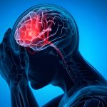 Why Trust Stem Cell Therapy For Treating Brain Damage?