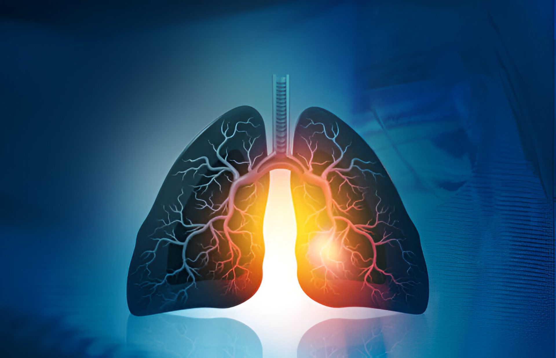 How To Suppress Inflammation for COPD and RA Patients with Stem Cell Therapy?