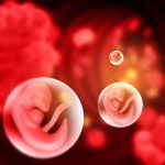 How To Treat Premature Ovarian Failure with Mesenchymal Stem Cell Therapy