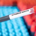 Stem Cell Therapy for Autoimmune Hepatitis: A Revolutionary Cure