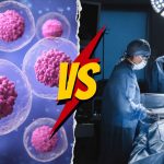 Stem Cell Therapy vs. Surgery: How To Pick The Right Treatment?