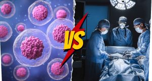 Stem Cell Therapy vs. Surgery: How To Pick The Right Treatment?