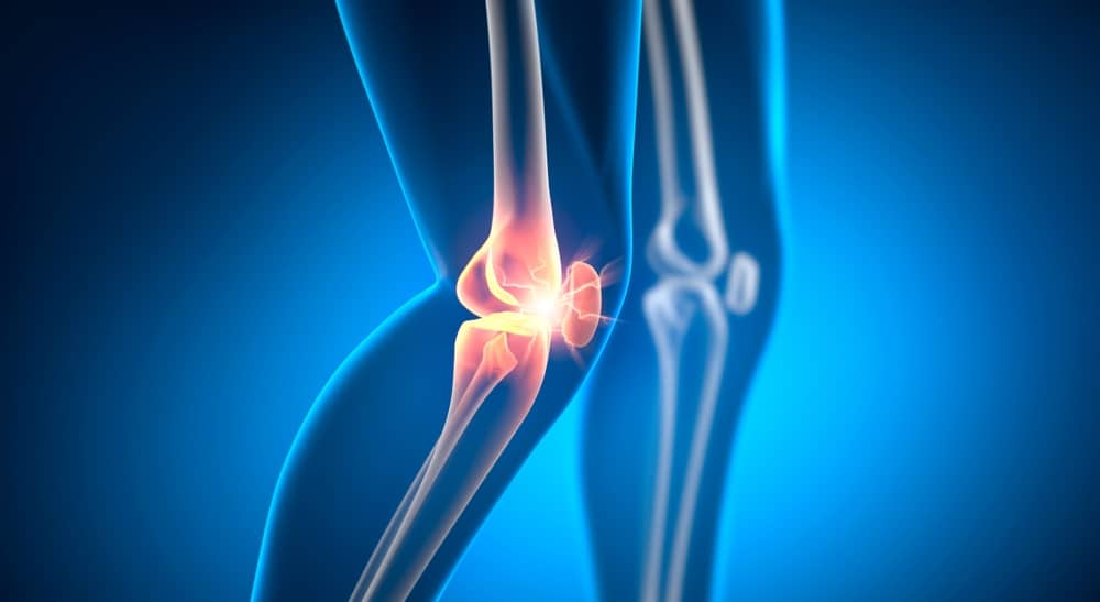 How To Manage Post-Meniscectomy Knee Pain with Stem Cell Therapy