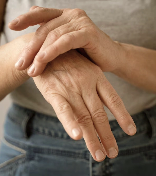 Rheumatoid Arthritis